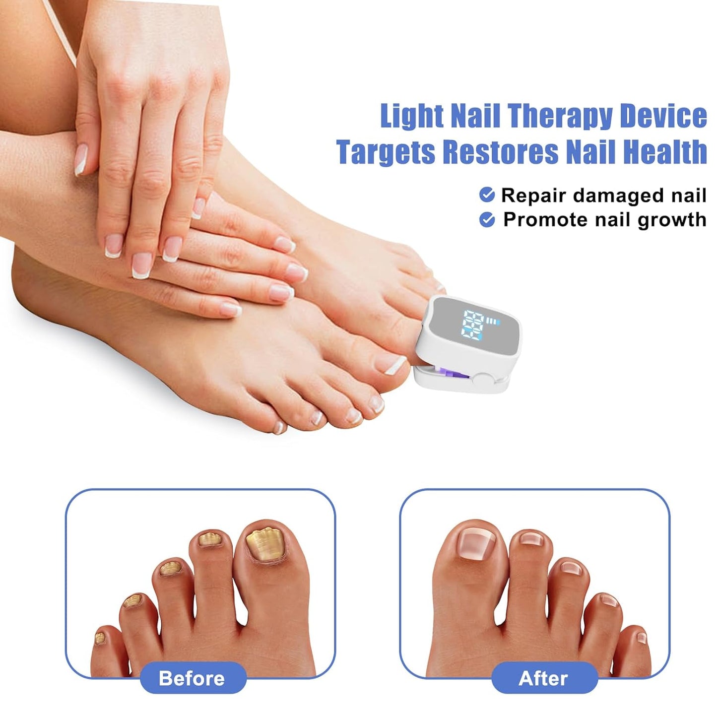 Fungal-Free Nail Light