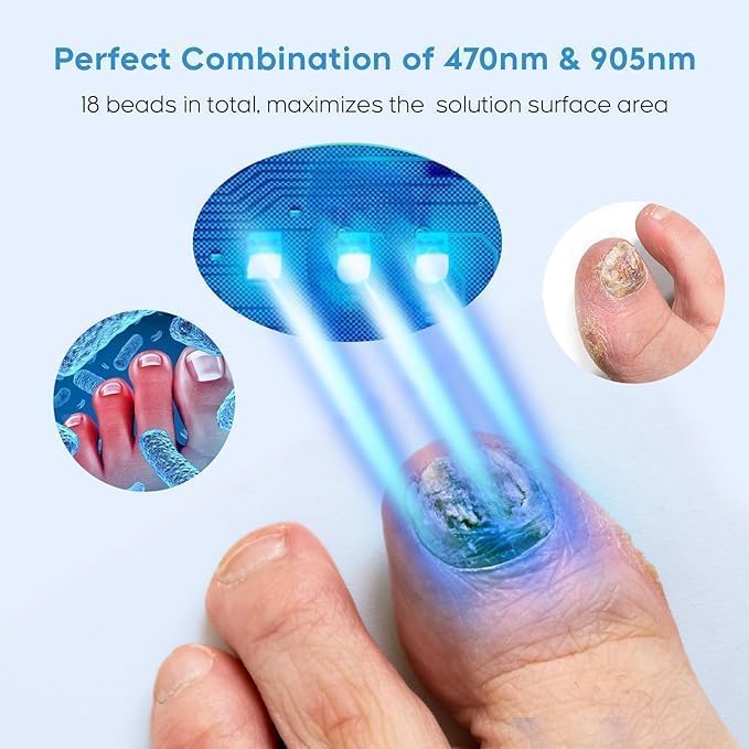 Easy Nail Health Laser Device
