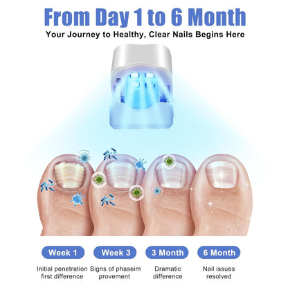 Fungal-Free Nail Light